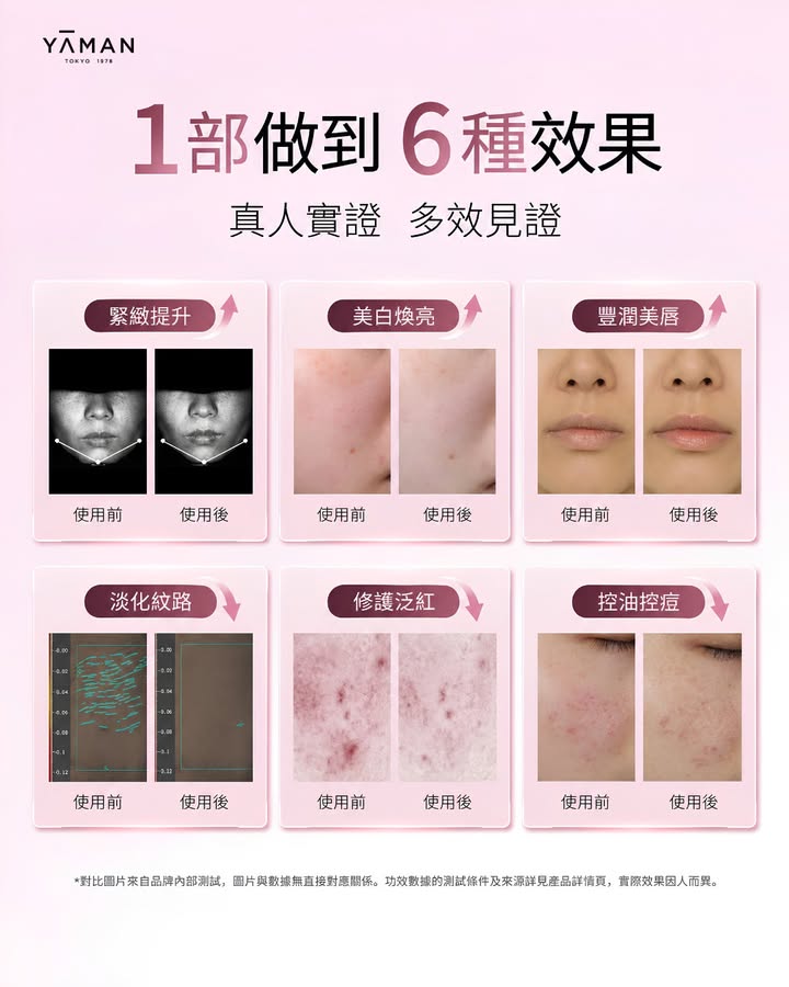 000｜額外享 HK$100現金回贈 ​ 全新YA-MAN閃修儀Pro現已登陸百老滙，想日常護膚再進階。