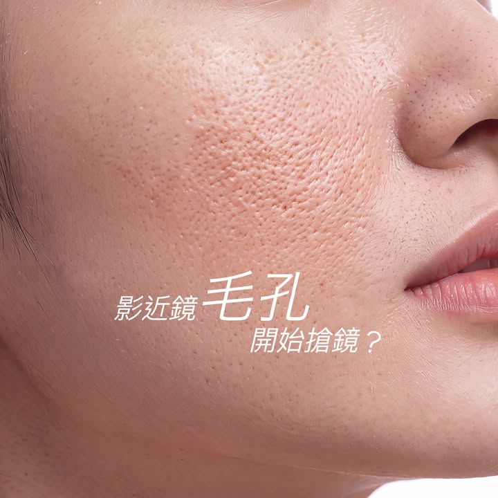 粗糙毛孔｜控油舒緩、緊緻毛孔 ・Avène控油舒緩面膜 只含14種成分的親膚天然竹炭布膜，10分鐘舒緩及減淡痘紅。
